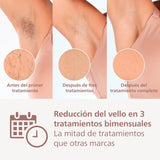 Philips Lumea Prestige IPL Epilator, Pulsed Light, Wireless, 4 Smart Heads (Body, Bikini, Underarms and Face) and SmartSkin Sensor, Pink BRI958/00
